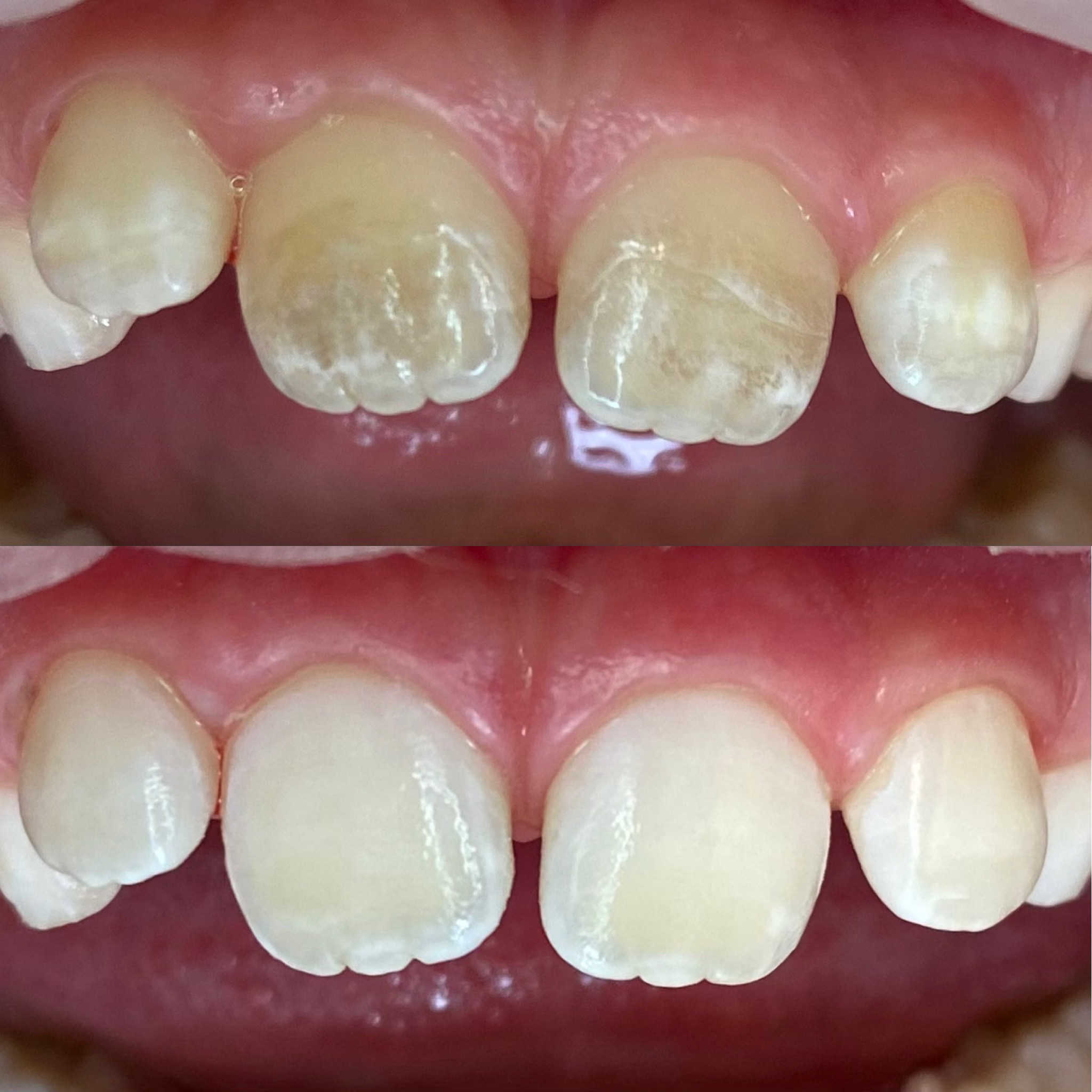 Dentálna Hygiena Košice v Zubnej Ambulancii Kapadent